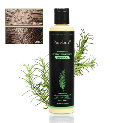 🔥LAST DAY 50% OFF - 🎅Purelora® Organic Rosemary Hair Growth Shampoo