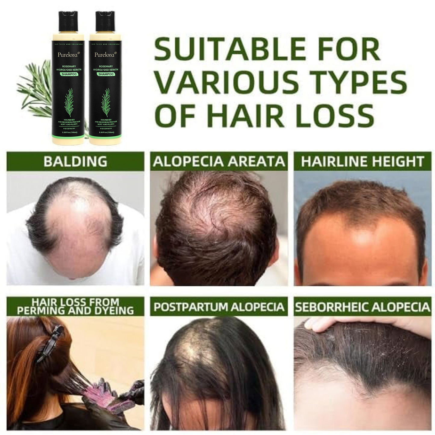 🔥LAST DAY 50% OFF - 🎅Purelora® Organic Rosemary Hair Growth Shampoo
