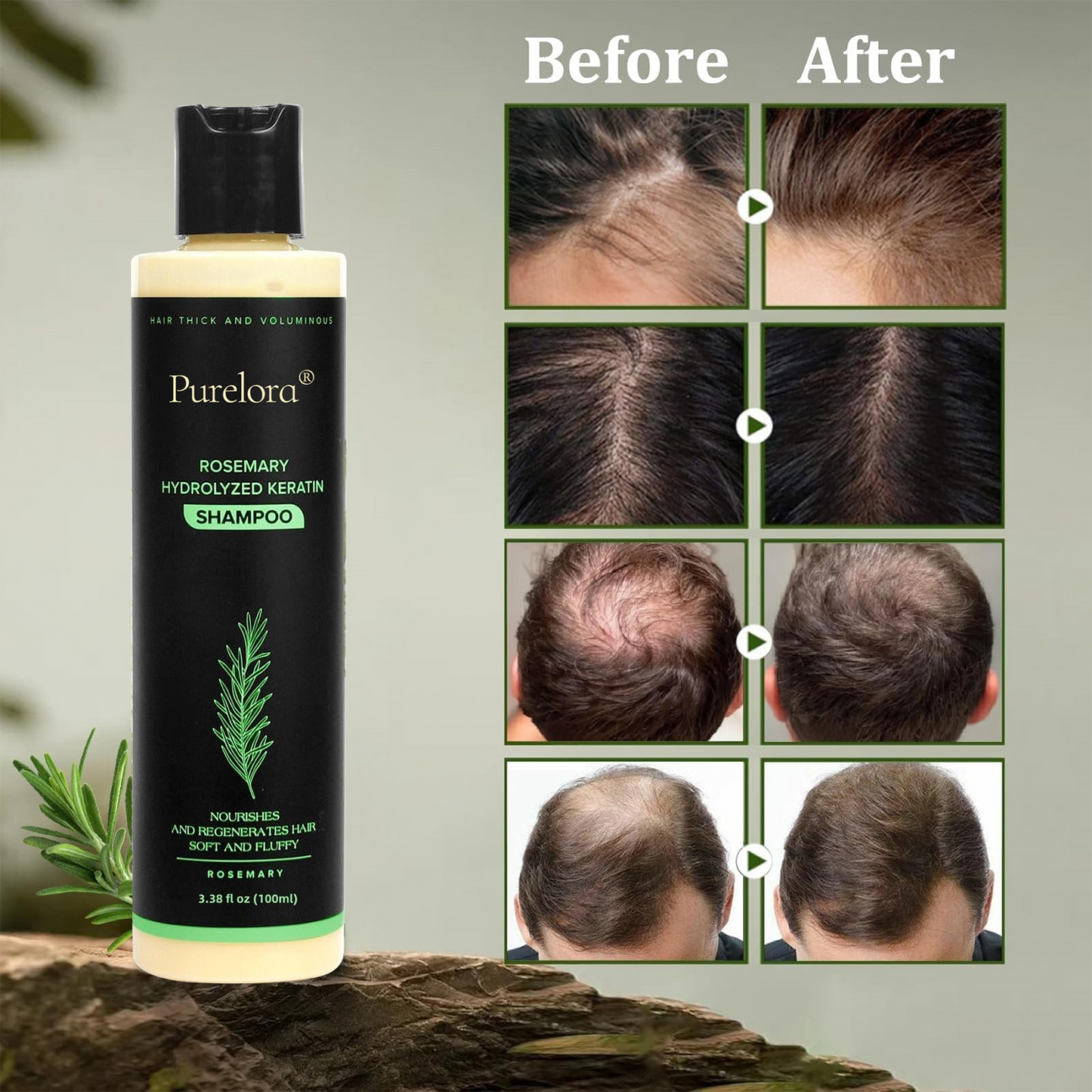 🔥LAST DAY 50% OFF - 🎅Purelora® Organic Rosemary Hair Growth Shampoo