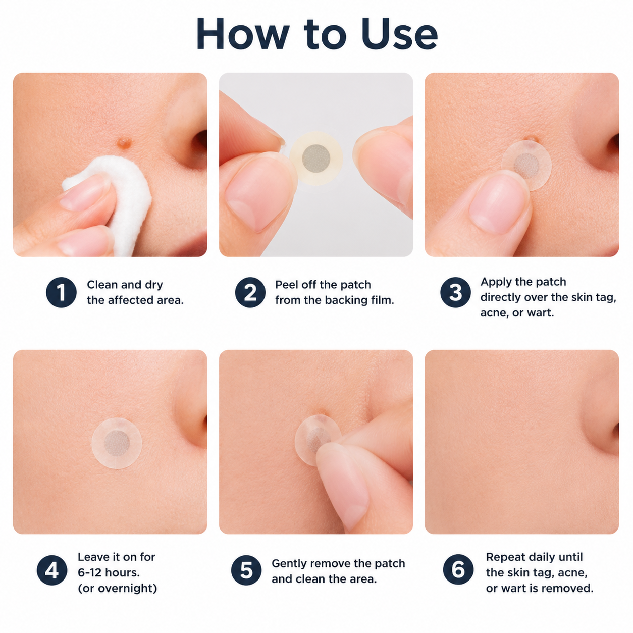 🔥 LAST DAY SALE-80% OFF ✨ Curalona®2-in-1 Microneedle & Hydrocolloid Patch🍀| Removes Raised Moles, Acne, Flat Warts & Skin Tags | Helps Improve Wrinkles, Scars & Blemishes | Invisible Patches for Face & Body
