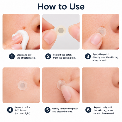 🔥 LAST DAY SALE-80% OFF ✨ Curalona®2-in-1 Microneedle & Hydrocolloid Patch🍀| Removes Raised Moles, Acne, Flat Warts & Skin Tags | Helps Improve Wrinkles, Scars & Blemishes | Invisible Patches for Face & Body