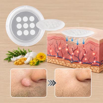 🔥 LAST DAY SALE-80% OFF ✨ Curalona®2-in-1 Microneedle & Hydrocolloid Patch🍀| Removes Raised Moles, Acne, Flat Warts & Skin Tags | Helps Improve Wrinkles, Scars & Blemishes | Invisible Patches for Face & Body